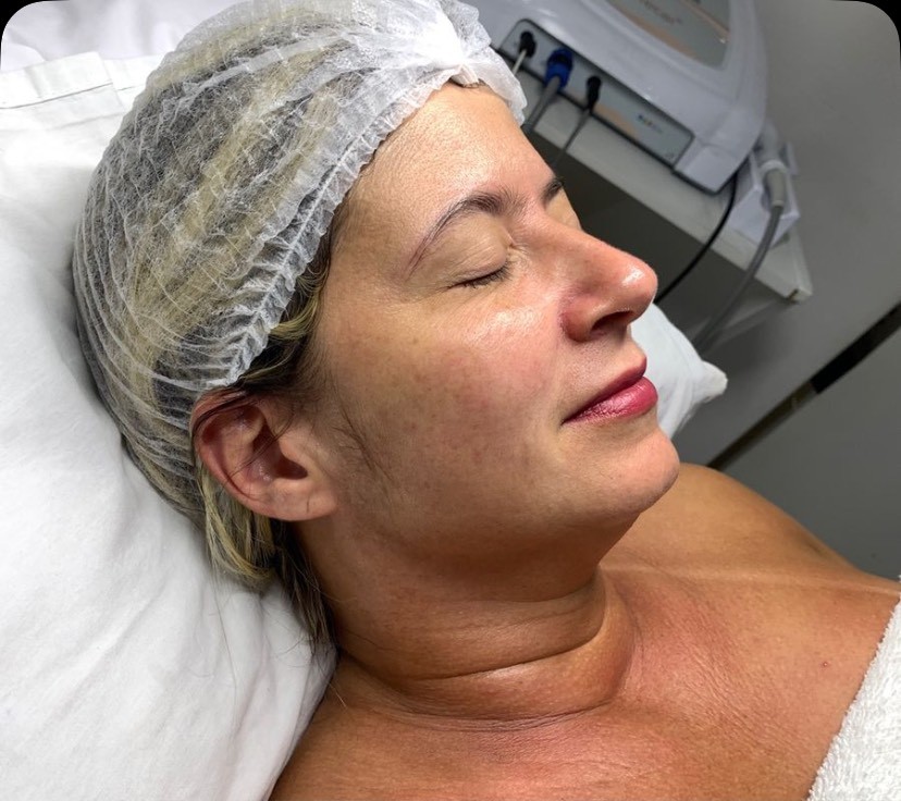 Tratamento facial